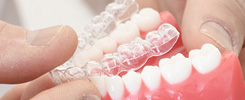 Invisalign
