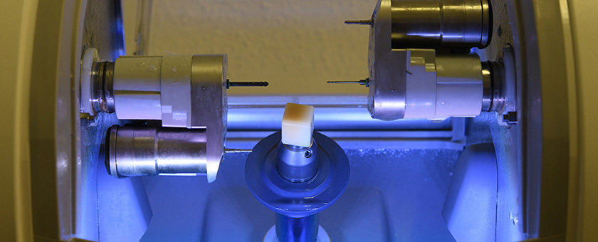 Zahnersatz in Rekordzeit im eigenen Labor gefertigt