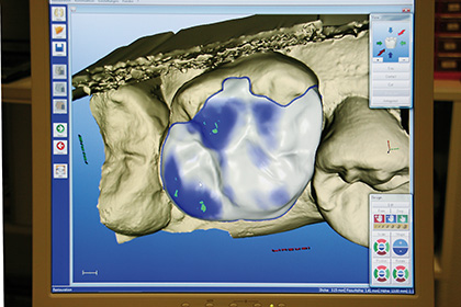 cerec computerbild