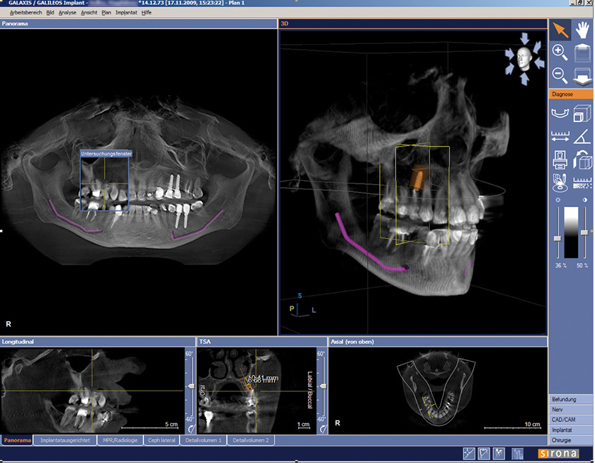 sirona screenshot loew armin