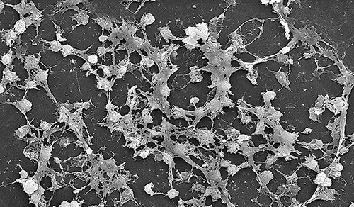 Staphylococcus on catheter