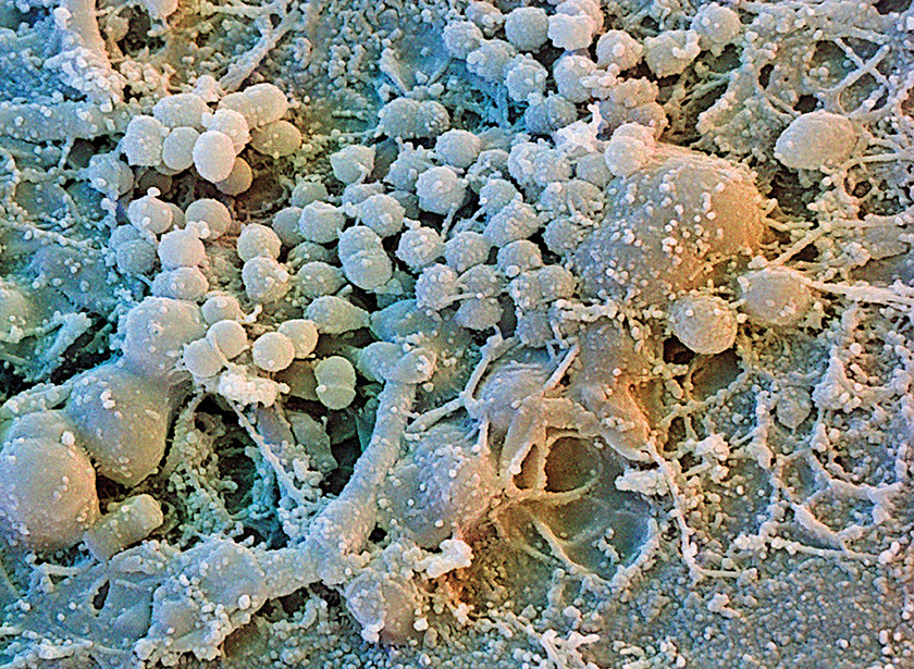 Biofilm Dental plaque KEYSTONE image high res