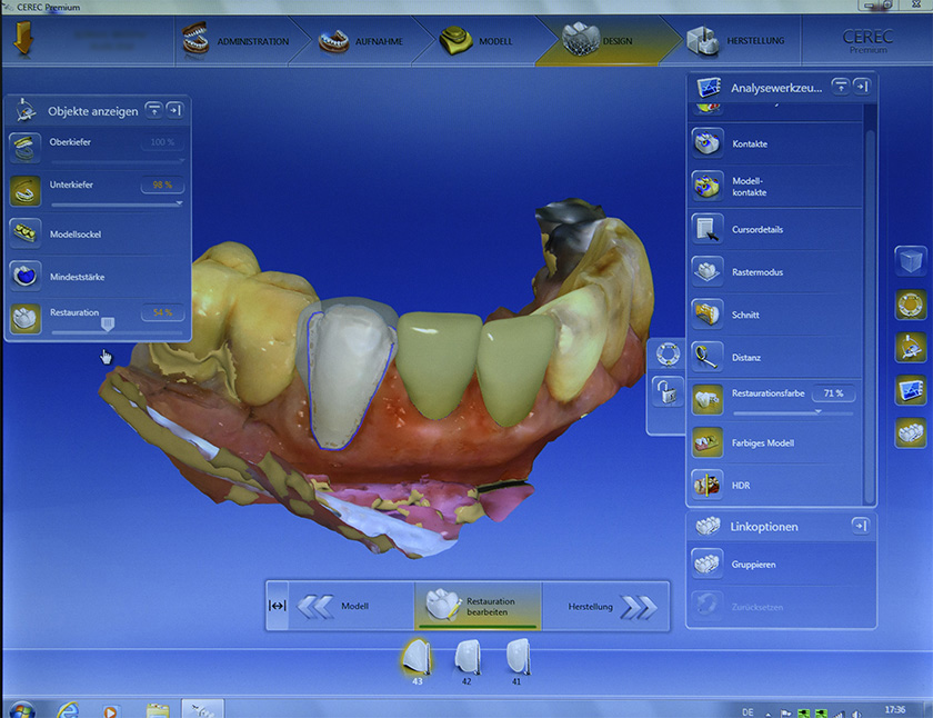 cerec screen 6904